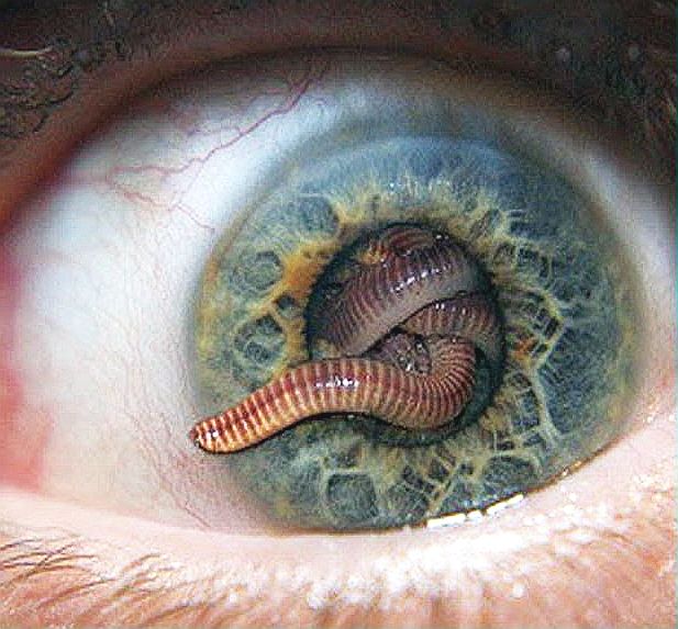 Matrix Parasitaria